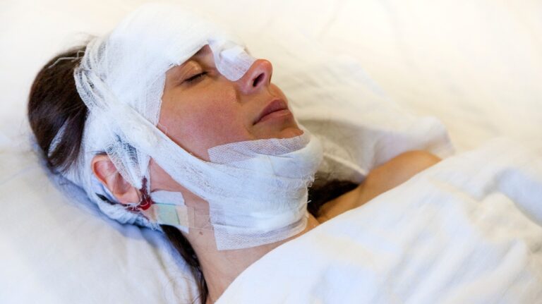 woman after surgery with a bandaged head lies on the bed