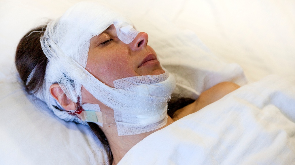 woman after surgery with a bandaged head lies on the bed