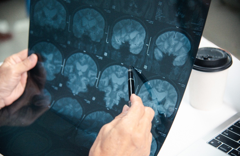 doctor is diagnosing brain problems