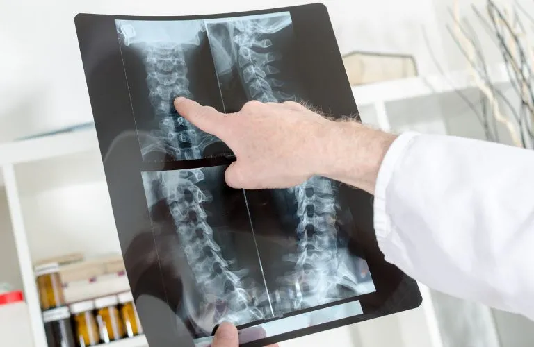 Medical professional pointing at cervical spine X-ray films in clinical setting.